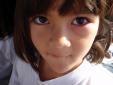 Oeil de Carmen infectÃ©